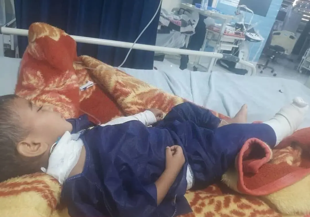 اولین عکس از کودک مجروحِ حملات بامدادی آمریکا