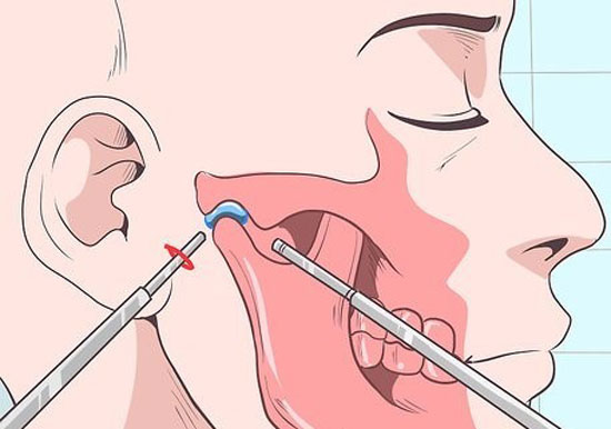 جراحی اختلال مفصل گیجگاهی فکی چگونه انجام می شود؟