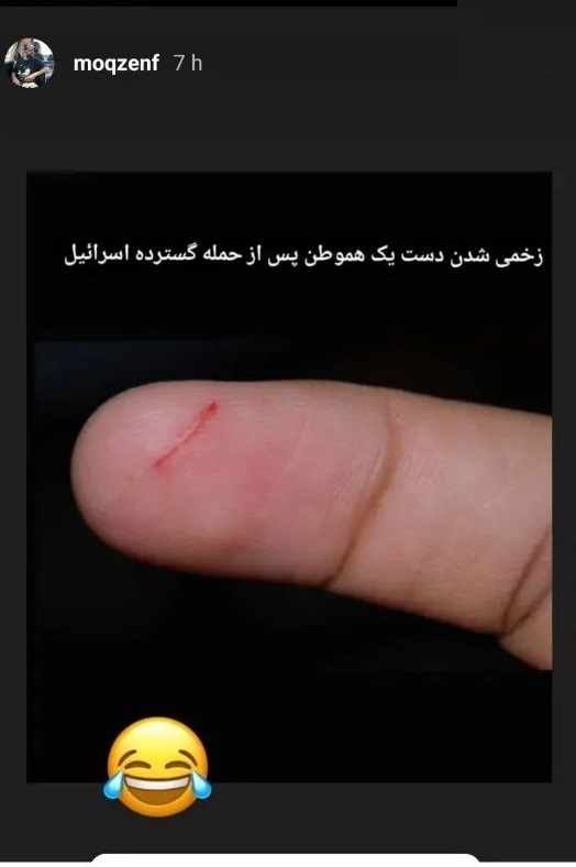 استوری تازه محسن افشانی با تصویری از یک انگشت زخمی