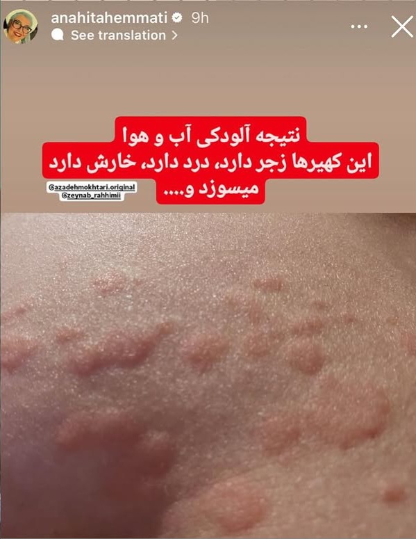 IMG_20251123_200602_133