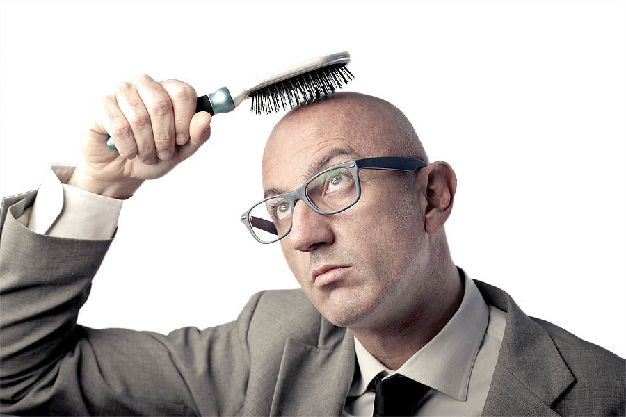 طاسی کامل چیست و چرا به کاشت مو نیاز دارد؟