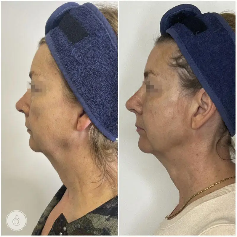 JKfMBGZXmG8S-IBU3keyYsTFaGUm_lfmjEExOJO7U5dy84heBpiXL9DF77IKZYQ_M4MDTpDOT2s49kdA7Y_0MVbxhIMgvr5hOGJqsqXuuSRoNTF2McgTYDLzUa4HSnuMJqrTTv_FxC6eMugSf_E24UrO5V14af-mF0BQfudo2hvbT6iC2gJXNsLoMk9x1TQN