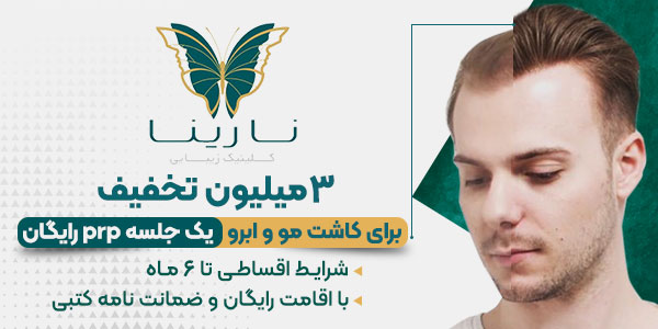 جراحی پیوند مو | انواع روش ها و هزینه