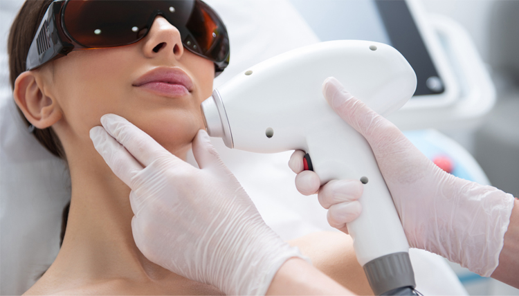 نحوه محاسبه هزینه لیزر موهای زائد به چه صورت است؟