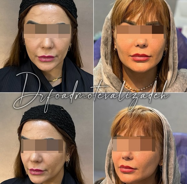 نمونه جوانساز نسل 4 دکتر فواد متولی زاده