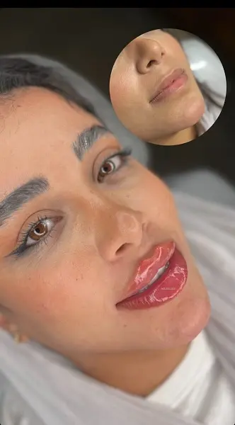 آرتا - ژل لب (2)