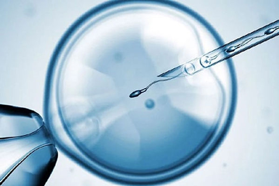 بچه دار شدن با IVF چگونه انجام می شود؟