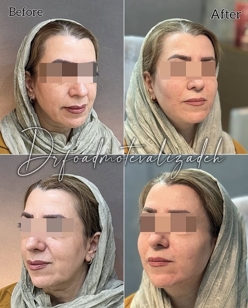 نمونه جوانساز نسل 4 دکتر فواد متولی زاده