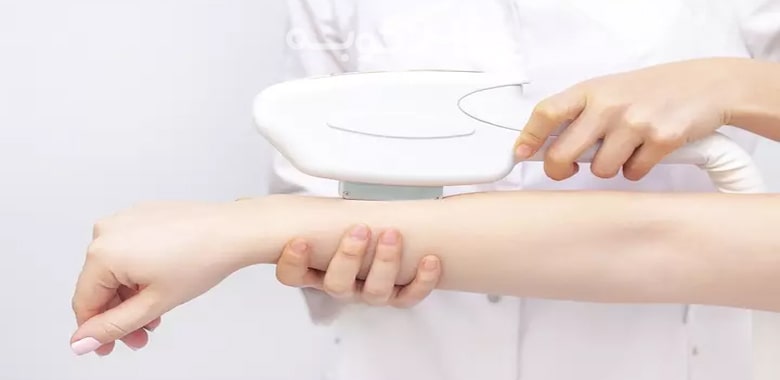 best-laser-hair-removal-center-tehran-1