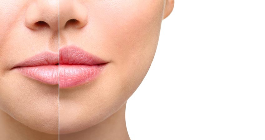 blog_resized_850_450_93_1538893000_lip_gel_injection