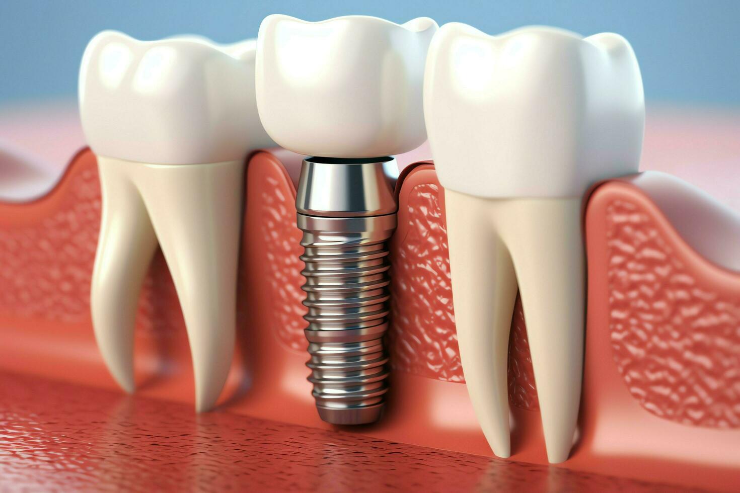 قبل از انتخاب ایمپلنت اقساطی به چه نکاتی باید توجه کنید؟