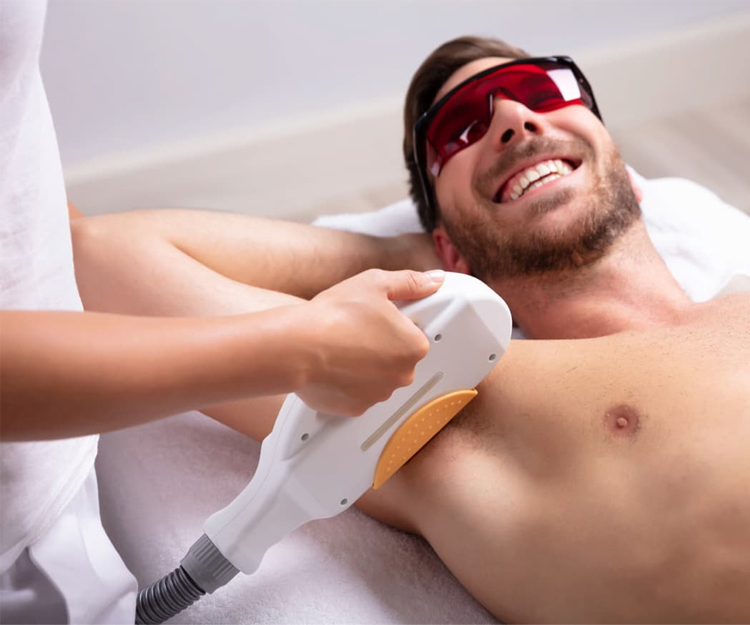 موهای زائد کدام نواحی بدن را می توان لیزر کرد؟