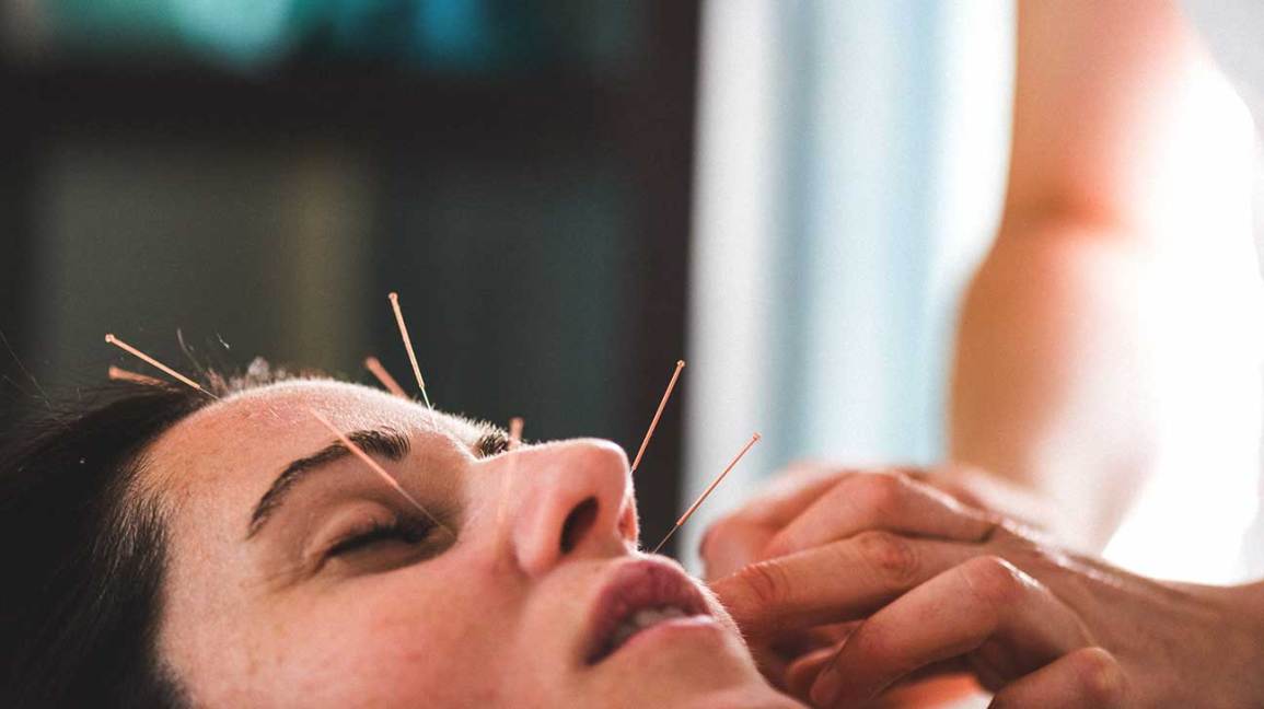 5840-_Woman_Facial_Acupuncture-1296x728-header