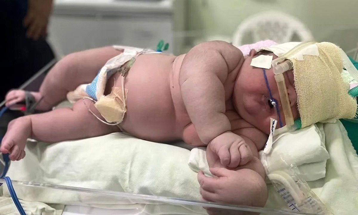 تولد نوزاد 7 کیلویی در مشهد!