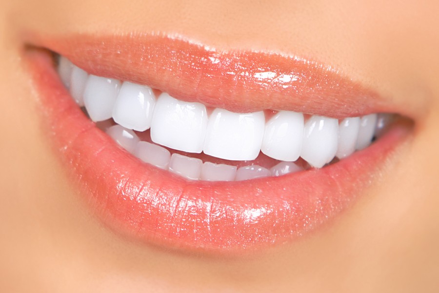 perfect-smile1