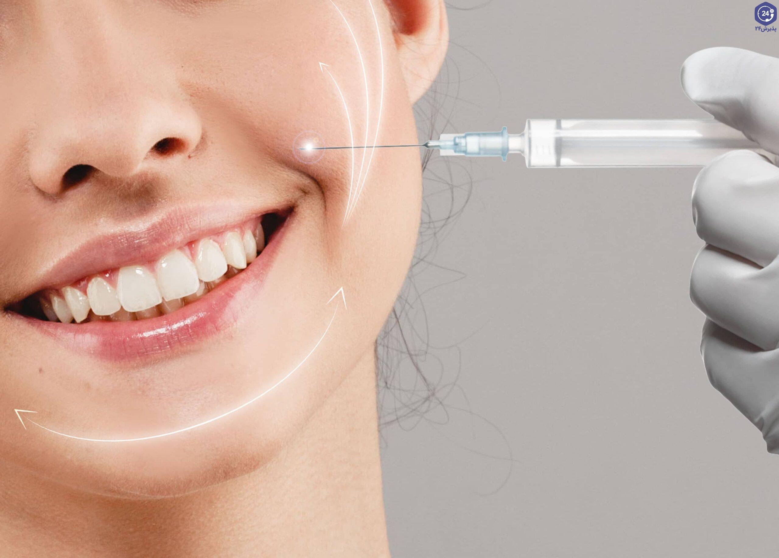 top-5-procedures-to-get-rid-of-smile-lines-to-get-scaled