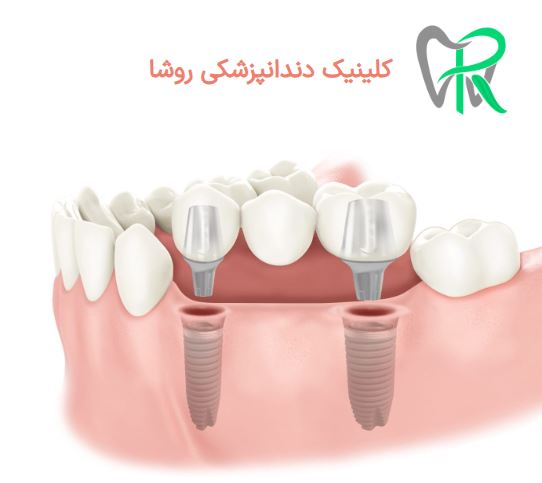 کلینیک دندانپزشکی روشا