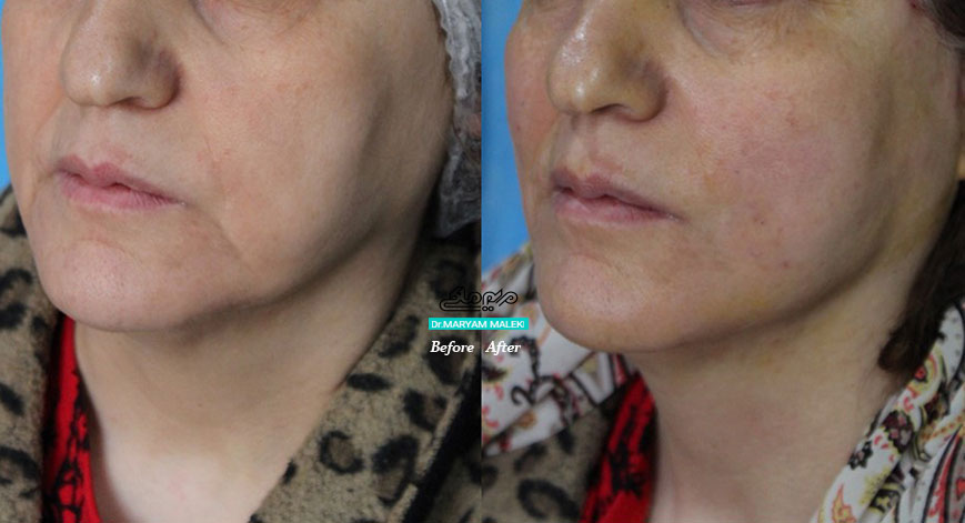 اسکار سالک چیست