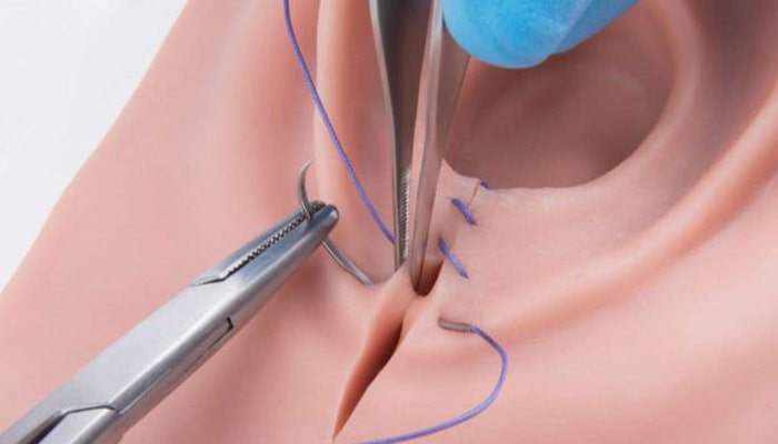 Vaginal-beauty-surgery-after-childbirth-