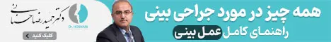 حسنانی - رندوم