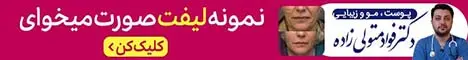 دکتر متولی زاده - رندوم