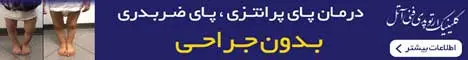 فنی آتل - استیکی پایین