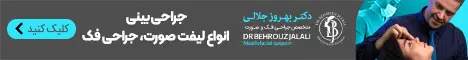 دکتر بهروز جلالی_f5 رندوم