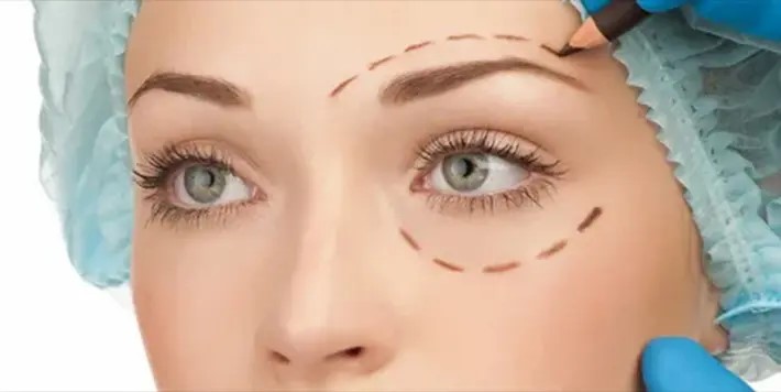 هزینه عمل بلفاروپلاستی پلک بالا و پایین چقدر است؟