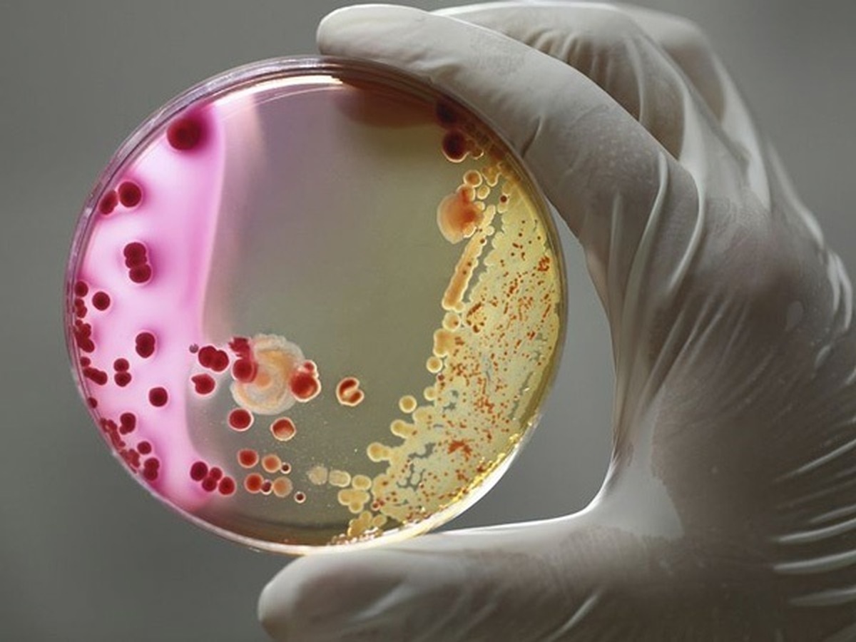 کشف یک باکتری جهش‌یافته و خطرناک در فضا 