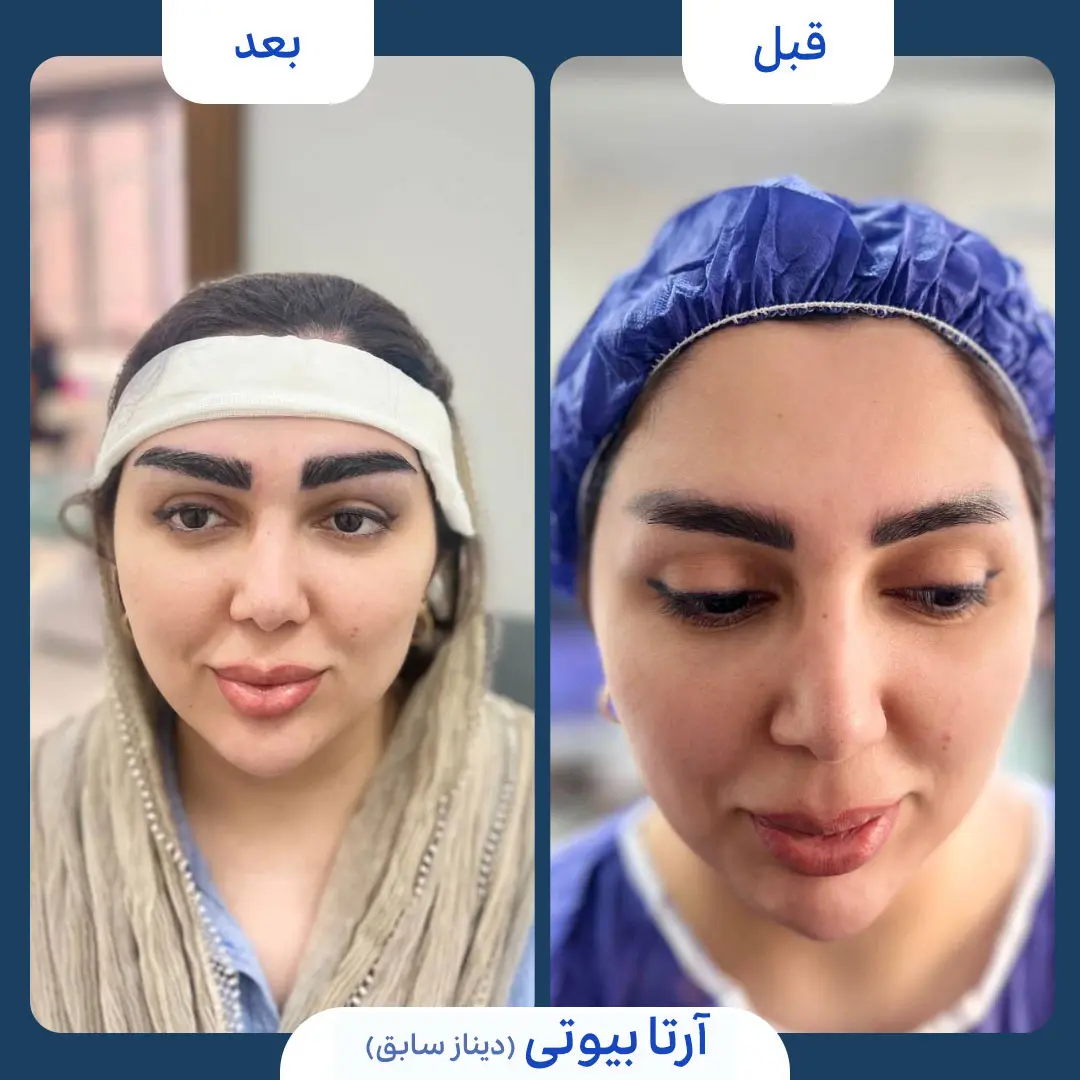 آرتا بیوتی2
