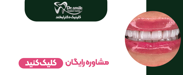 دکتر لبخند - بنر فوتر