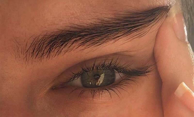کاشت-ابرو-قبل-و-بعد-
