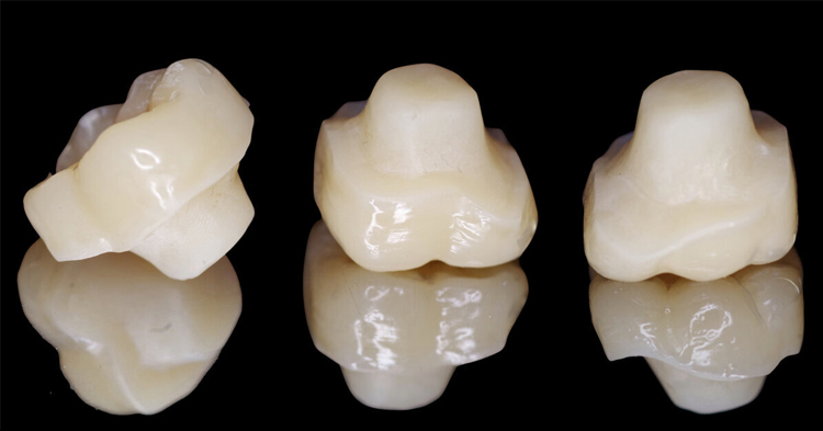 اندوکران چیست؟