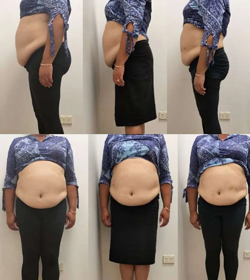 چه کسانی نباید از روش امبدینگ استفاده کنند؟