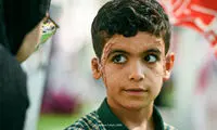 تصویری تلخ از آثار بمباران روی صورت دانش‌آموز مینابی