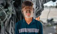 تصاویری از این ۱۷نفر که به یک دلیل خاص چهره منحصر به فرد دارند!