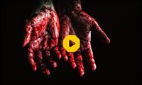  تصاویری هولناک از درگیری با قمه در یک بیمارستان