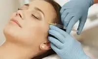  بهترین دکتر تزریق فیلر شقیقه کیست؟ + لیست 10 پزشک برتر