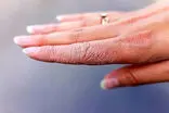 ۶ روش خانگی برای نجات پوست خشک در روزهای سرد