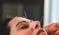 طب سوزنی چیست و چه تأثیر بر بدن دارد؟
