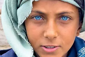 چشمان جادویی این کودک او را یک‌شبه معروف کرد