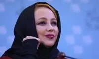 چهره مصنوعی بهنوش بختیاری تو ذوق خورد!
