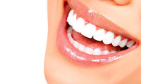 روکش دندان و لمینت چه تفاوتی باهم دارند؟
