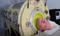 مردی که ۷۰ سال با یک ریه آهنی زندگی کرد، درگذشت