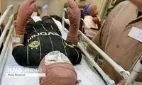 تصاویر دلخراش از 4قربانی مواد محترقه در مشهد
