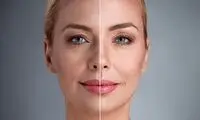 بهترین دکتر لیفت گونه چه ویژگی‌هایی دارد؟ + معرفی 10 دکتر برتر