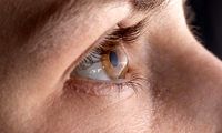 چرا چشم ایرانی‌ها بیشتر درگیر قوز قرنیه است؟