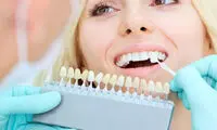 آیا لمینت دندان دائمی است؟ بررسی ماندگاری لمینت دندان