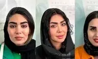 معرفی کلینیک میکروکاشت ابرو لاله در تهران  + هزینه