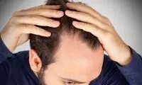 این روغن رشد موها را سریع می‌کند